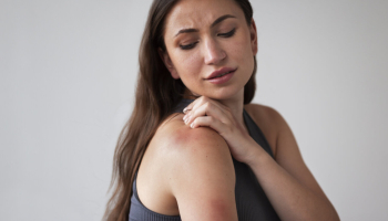 Cómo puede afectar el estrés a la salud de tu piel